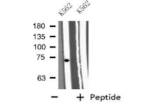 Western blot analysis of extracts from K562 cells, using GAB2 antibody. (GAB2 抗体  (C-Term))