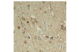 Immunohistochemistry of paraffin-embedded Rat hippocampal region tissue from a model with Alzheimer, using Phospho-Tau(S396) Polyclonal Antibody (tau 抗体  (pSer396))