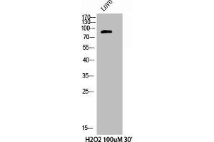 Western Blot analysis of LOVO+H2O2 cells using Phospho-Cortactin (Y421) Polyclonal Antibody (Cortactin 抗体  (pTyr421))