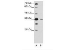 Image no. 2 for anti-DAZ Associated Protein 1 (DAZAP1) (C-Term) antibody (ABIN6736222) (DAZAP1 抗体  (C-Term))
