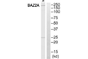 Western blot analysis of extracts from Jurkat cells, using BAZ2A antibody. (BAZ2A 抗体)