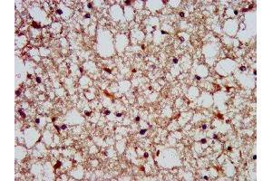 IHC image of ABIN7169777 diluted at 1:300 and staining in paraffin-embedded human brain tissue performed on a Leica BondTM system. (SLAIN1 抗体  (AA 43-136))
