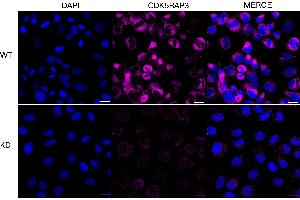 anti-CDK5 Regulatory Subunit Associated Protein 3 (CDK5RAP3) antibody