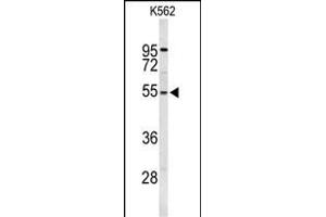 Western blot analysis of RPS6KB2 Antibody (ABIN652424 and ABIN2842096) in K562 cell line lysates (35 μg/lane). (RPS6KB2 抗体)