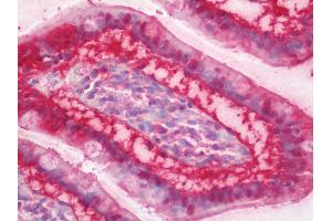 Human Small Intestine: Formalin-Fixed, Paraffin-Embedded (FFPE)