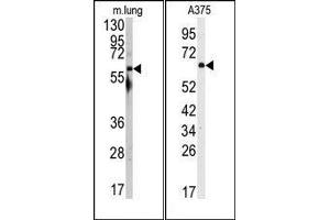 Image no. 1 for anti-Nuclear Receptor Coactivator 1 (NCOA1) (N-Term) antibody (ABIN359992) (NCOA1 抗体  (N-Term))