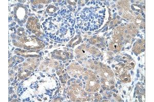 Immunohistochemistry (IHC) image for anti-Sarcosine Dehydrogenase (SARDH) (Middle Region) antibody (ABIN2775361) (SARDH 抗体  (Middle Region))
