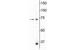 Western blot of mouse whole brain lysate showing specific immunolabeling of the MeCP2 protein at ~75 kDa. (MECP2 抗体)