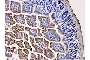 NARG1 was detected in paraffin-embedded sections of mouse intestine tissues using rabbit anti- NARG1 Antigen Affinity purified polyclonal antibody (Catalog # ) at 1 µg/mL. (NAA15 抗体  (N-Term))
