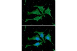 ICC/IF analysis of Calmodulin in HeLa cells. (Calmodulin 1 抗体)