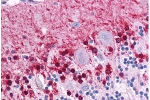 Human Brain, Cerebellum: Formalin-Fixed, Paraffin-Embedded (FFPE) (KLF2 抗体  (AA 216-265))