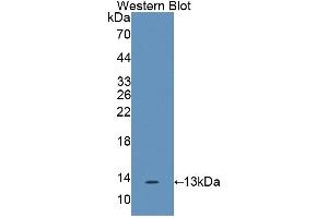 Western blot analysis of the recombinant protein. (IL17F 抗体  (AA 31-163))