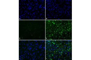 Primary rat hippocampal neurons show lewy body inclusion formation when treated with active Alpha Synuclein Protein Aggregate  at 4 µg/ml (D-F), but not when treated with control Alpha Synuclein Protein Aggregate  at 4 µg/ml (A-C). (SNCA Protein (full length))