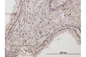 Immunoperoxidase of purified MaxPab antibody to RNF111 on formalin-fixed paraffin-embedded human prostate. (RNF111 抗体  (AA 1-985))