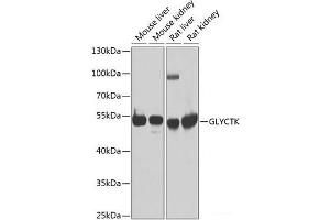 Western blot analysis of extracts of various cell lines using GLYCTK Polyclonal Antibody at dilution of 1:1000. (GLYCTK 抗体)