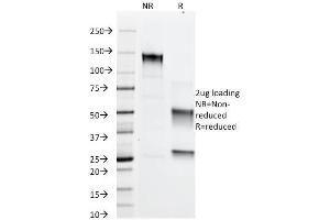 SDS-PAGE Analysis Purified Adipophilin Mouse Monoclonal Antibody (ADFP/1366). (ADRP 抗体  (AA 249-376))