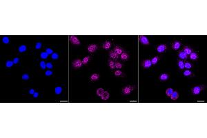 anti-Denticleless E3 Ubiquitin Protein Ligase Homolog (DTL) antibody