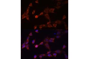 Immunofluorescence (IF) image for anti-Proteasome (Prosome, Macropain) 26S Subunit, Non-ATPase, 14 (PSMD14) (AA 160-300) antibody (ABIN6146340)