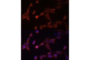 Immunofluorescence analysis of NIH-3T3 cells using PSMD14 Polyclonal Antibody (ABIN6131927, ABIN6146340, ABIN6146341 and ABIN6214977) at dilution of 1:100 (40x lens). (PSMD14 抗体  (AA 160-300))