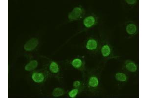 Anti-ACTN1 mouse monoclonal antibody (ABIN2452359) immunofluorescent staining of HeLa cells transiently transfected by pCMV6-ENTRY ACTN1 (RC204924) (ACTN1 抗体  (AA 650-893))