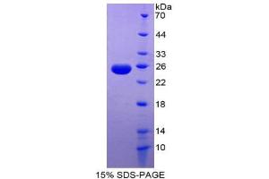 SDS-PAGE (SDS) image for TNF Like Ligand 1A (AA 67-251) protein (His tag) (ABIN1981097) (TNF Like Ligand 1A (AA 67-251) protein (His tag))