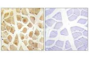 Immunohistochemistry analysis of paraffin-embedded human skeletal muscle tissue using SLK antibody. (SLK 抗体  (C-Term))