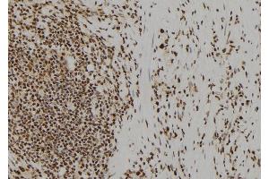 ABIN6277616 at 1/100 staining Human gastric tissue by IHC-P. (UROD 抗体  (C-Term))