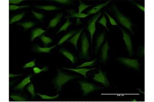 Immunofluorescence of monoclonal antibody to SSH1 on HeLa cell. (SSH1 抗体  (AA 950-1049))