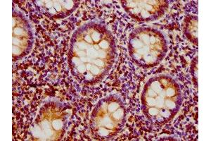 IHC image of ABIN7157950 diluted at 1:500 and staining in paraffin-embedded human appendix tissue performed on a Leica BondTM system. (LIME 抗体  (AA 170-295))