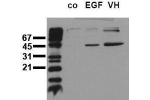 Western Blotting (WB) image for anti-Mitogen-Activated Protein Kinase Kinase 1 (MAP2K1) (pSer218), (pSer222), (pSer226) antibody (ABIN126836) (MEK1 抗体  (pSer218, pSer222, pSer226))