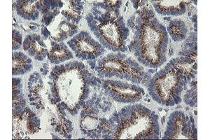 Image no. 2 for anti-RAB30, Member RAS Oncogene Family (RAB30) antibody (ABIN1500557) (RAB30 抗体)