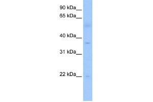 WB Suggested Anti-RG9MTD3 Antibody Titration:  0. (RG9MTD3 抗体  (C-Term))