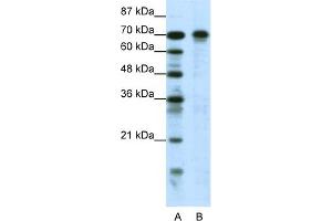WB Suggested Anti-HIC1 Antibody Titration:  0. (HIC1 抗体  (N-Term))