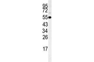 Western blot analysis of RIPK3 antibody and HeLa lysate (RIPK3 抗体  (AA 61-91))