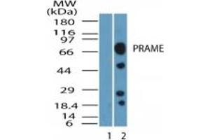 Image no. 1 for anti-Preferentially Expressed Antigen in Melanoma (PRAME) (AA 460-510) antibody (ABIN232167)