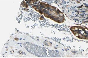 Immunohistochemistry (IHC) image for anti-Activin A Receptor Type II-Like 1 (ACVRL1) (Internal Region) antibody (ABIN6256992)