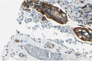ABIN6274247 at 1/100 staining Mouse intestine tissue by IHC-P.