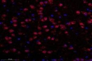 Immunofluorescent analysis of paraformaldehyde-fixed mouse substantia nigra using TBXT (ABIN7075815) at dilution of 1: 600 (T-Box 19 抗体)