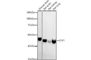 Western blot analysis of extracts of various cell lines, using ETV1 antibody (ABIN6129795, ABIN6140328, ABIN6140330 and ABIN6223003) at 1:1000 dilution. (ETV1 抗体  (AA 1-200))