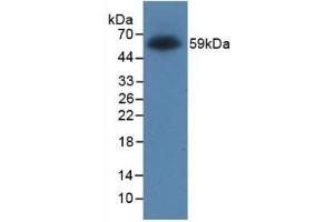 Detection of Recombinant Protein RPK170Hu01 with GST-tag using Anti-Glutathione S Transferase (GST) Tag Monoclonal Antibody (GST 抗体  (AA 1-218))