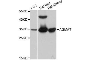 Western blot analysis of extracts of various cell lines, using AGMAT antibody. (AGMAT 抗体)