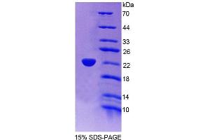 SDS-PAGE analysis of Mouse ACOX3 Protein. (ACOX3 蛋白)