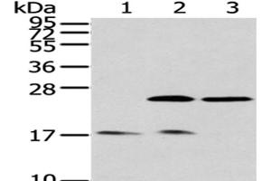 Western Blot analysis of Human fetal brain tissue, Hela and 293T cells using PDPN Polyclonal Antibody at dilution of 1/200 (Podoplanin 抗体)