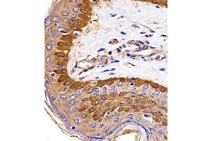 Paraformaldehyde-fixed, paraffin embedded human skin tissue, Antigen retrieval by boiling in sodium citrate buffer (pH6. (S100A2 抗体)