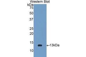 Western Blotting (WB) image for anti-beta-2-Microglobulin (B2M) (AA 22-119) antibody (ABIN1077854) (beta-2 Microglobulin 抗体  (AA 22-119))