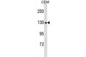 Western Blotting (WB) image for anti-Non-SMC Condensin I Complex, Subunit G (NCAPG) antibody (ABIN3000708)