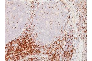 Formalin-fixed, paraffin-embedded human Tonsil stained with CD5 Mouse Monoclonal Antibody (CD5/54/F6). (CD5 抗体)