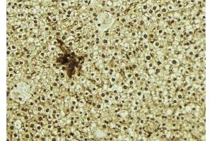 ABIN6273274 at 1/100 staining Mouse liver tissue by IHC-P. (NR1D1 抗体  (N-Term))
