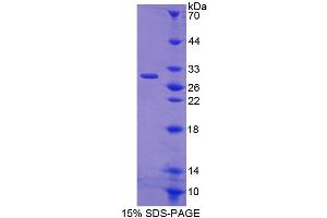 SDS-PAGE analysis of Rat CRISP1 Protein. (CRISP1 蛋白)