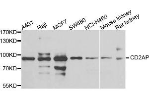 Western blot analysis of extracts of various cells, using CD2AP antibody. (CD2AP 抗体)